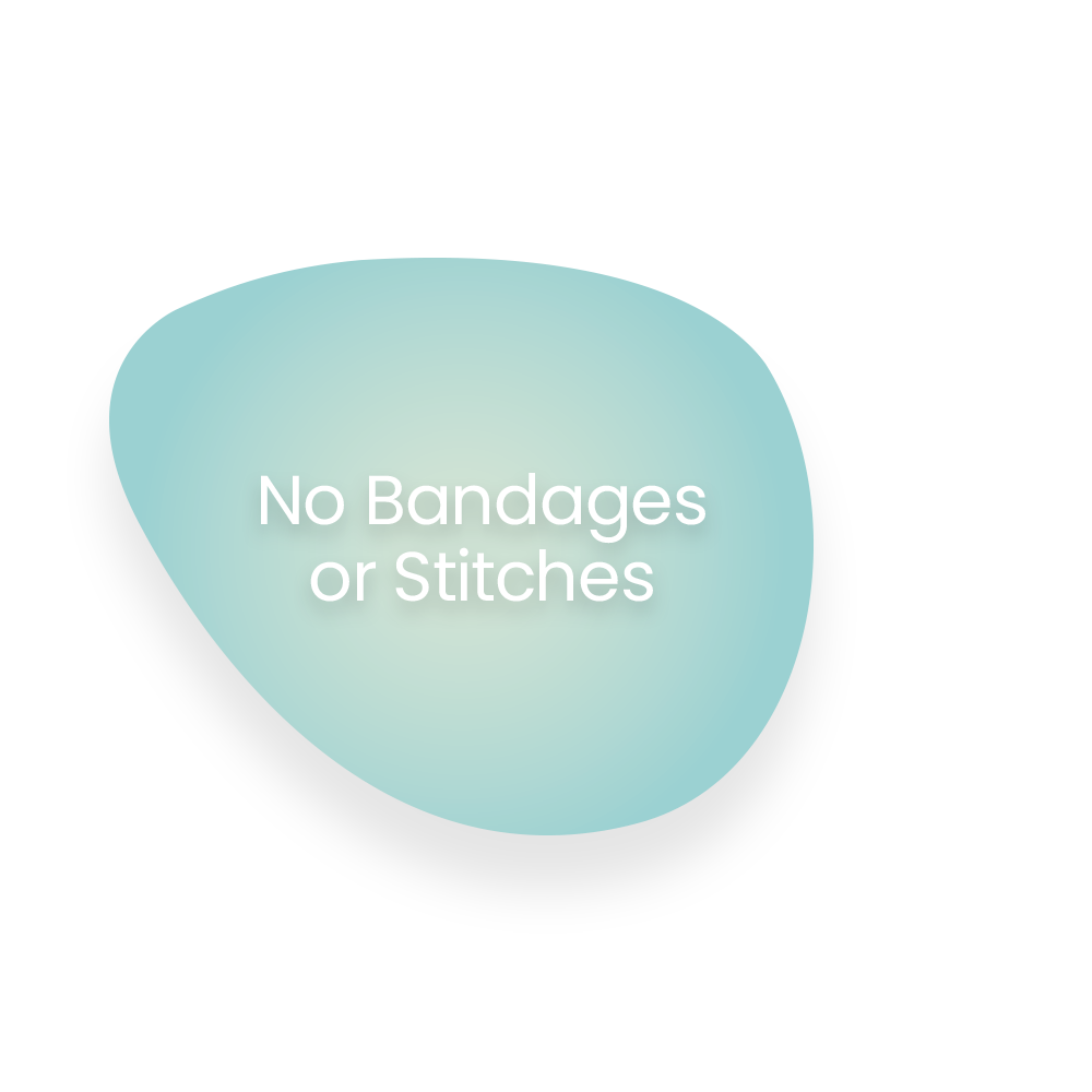 No Bandages or Stitches